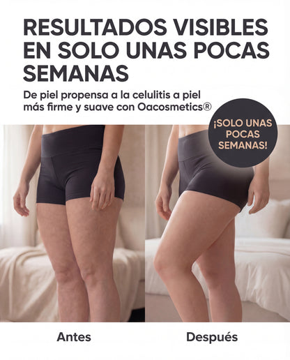 ÔA SculptGlow™ –Masajeador Anticelulítico por Succión Dinámica Inteligente con Vacío Eléctrico, Luz de Alta Energía y Terapia Reafirmante Corporal
